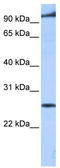Phospholipid Phosphatase 5 antibody, TA339613, Origene, Western Blot image 
