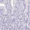Serpin Family I Member 1 antibody, HPA056092, Atlas Antibodies, Immunohistochemistry paraffin image 