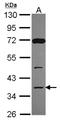 Decapping Enzyme, Scavenger antibody, NBP2-16111, Novus Biologicals, Western Blot image 
