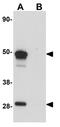 Secernin 1 antibody, GTX85172, GeneTex, Western Blot image 