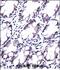 Phospholipase A And Acyltransferase 5 antibody, PA5-48645, Invitrogen Antibodies, Immunohistochemistry frozen image 