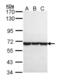 Chaperonin Containing TCP1 Subunit 8 antibody, NBP1-33486, Novus Biologicals, Western Blot image 