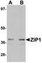 Zinc transporter ZIP1 antibody, NBP1-76498, Novus Biologicals, Western Blot image 