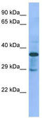 C1GALT1-specific chaperone 1 antibody, TA335381, Origene, Western Blot image 