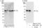 TELO2 Interacting Protein 2 antibody, NBP1-80571, Novus Biologicals, Immunoprecipitation image 