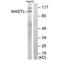 Microtubule Associated Serine/Threonine Kinase Like antibody, PA5-49870, Invitrogen Antibodies, Western Blot image 