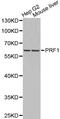 Perforin 1 antibody, LS-C192436, Lifespan Biosciences, Western Blot image 