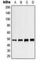 Potassium Voltage-Gated Channel Subfamily J Member 5 antibody, LS-B14284, Lifespan Biosciences, Western Blot image 