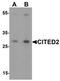 Cbp/P300 Interacting Transactivator With Glu/Asp Rich Carboxy-Terminal Domain 2 antibody, TA319054, Origene, Western Blot image 