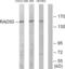 RAD50 Double Strand Break Repair Protein antibody, LS-C119593, Lifespan Biosciences, Western Blot image 
