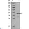 ABL Proto-Oncogene 1, Non-Receptor Tyrosine Kinase antibody, LS-C812408, Lifespan Biosciences, Western Blot image 