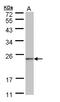 NADH:Ubiquinone Oxidoreductase Complex Assembly Factor 4 antibody, LS-C186049, Lifespan Biosciences, Western Blot image 