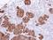 S100 Calcium Binding Protein A11 antibody, GTX100698, GeneTex, Immunohistochemistry paraffin image 