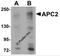 APC Regulator Of WNT Signaling Pathway 2 antibody, 5721, ProSci, Western Blot image 