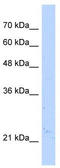 Nudix Hydrolase 16 Like 1 antibody, TA346644, Origene, Western Blot image 