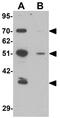 Thymopoietin antibody, GTX31844, GeneTex, Western Blot image 