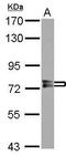 Protein Phosphatase With EF-Hand Domain 1 antibody, GTX114652, GeneTex, Western Blot image 