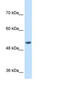 Signal Peptide Peptidase Like 2B antibody, MBS839114, MyBioSource, Western Blot image 