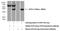 Acid Phosphatase 5, Tartrate Resistant antibody, 11594-1-AP, Proteintech Group, Western Blot image 