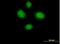 Hematopoietic SH2 domain-containing protein antibody, H00084941-B01P, Novus Biologicals, Immunofluorescence image 