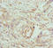 Conserved oligomeric Golgi complex subunit 5 antibody, LS-C675562, Lifespan Biosciences, Immunohistochemistry paraffin image 