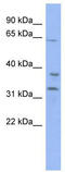 Kelch repeat and BTB domain-containing protein 5 antibody, TA337280, Origene, Western Blot image 