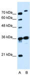 Solute Carrier Family 9 Member A7 antibody, TA333608, Origene, Western Blot image 