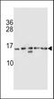 Histone Cluster 1 H2A Family Member E antibody, MBS9208191, MyBioSource, Western Blot image 