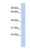 Zinc Finger Protein 75a antibody, NBP1-80172, Novus Biologicals, Western Blot image 