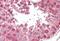 Conserved oligomeric Golgi complex subunit 7 antibody, GTX88563, GeneTex, Immunohistochemistry paraffin image 