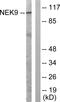 Serine/threonine-protein kinase Nek9 antibody, A04660, Boster Biological Technology, Western Blot image 