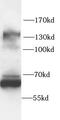 Nuclear Factor Of Activated T Cells 3 antibody, FNab10459, FineTest, Western Blot image 