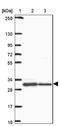 Homeostatic Iron Regulator antibody, NBP2-38702, Novus Biologicals, Western Blot image 