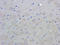 C-X-C Motif Chemokine Ligand 8 antibody, orb322984, Biorbyt, Immunohistochemistry paraffin image 