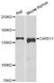 Caspase recruitment domain-containing protein 11 antibody, orb247828, Biorbyt, Western Blot image 