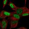Homeobox protein TGIF2LX antibody, NBP1-86320, Novus Biologicals, Immunofluorescence image 
