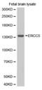 DNA repair protein complementing XP-G cells antibody, MBS127808, MyBioSource, Western Blot image 