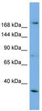 Alsin Rho Guanine Nucleotide Exchange Factor ALS2 antibody, TA344753, Origene, Western Blot image 