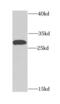 Coiled-Coil-Helix-Coiled-Coil-Helix Domain Containing 3 antibody, FNab01636, FineTest, Western Blot image 