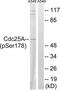Cell Division Cycle 25A antibody, TA313593, Origene, Western Blot image 