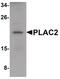 Placenta-specific protein 2 antibody, PA5-21045, Invitrogen Antibodies, Western Blot image 