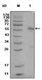 Estrogen Receptor 1 antibody, AM06288SU-N, Origene, Western Blot image 