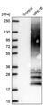 Uroplakin 1B antibody, NBP1-80657, Novus Biologicals, Western Blot image 