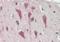 Myosin Binding Protein C, Fast Type antibody, orb73961, Biorbyt, Immunohistochemistry paraffin image 