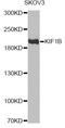Kinesin Family Member 1B antibody, MBS129754, MyBioSource, Western Blot image 