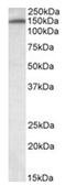 Aldehyde Dehydrogenase 1 Family Member A1 antibody, AP31103PU-N, Origene, Western Blot image 