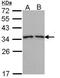 Tropomyosin 3 antibody, PA5-29770, Invitrogen Antibodies, Western Blot image 