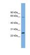 Dihydrofolate Reductase 2 antibody, NBP1-55510, Novus Biologicals, Western Blot image 