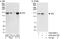Cohesin subunit SA-2 antibody, A302-581A, Bethyl Labs, Immunoprecipitation image 