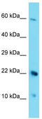 CFAP97 Domain Containing 1 antibody, TA334845, Origene, Western Blot image 